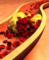 cholesterol - Aloe 
Vera - Probiotiques